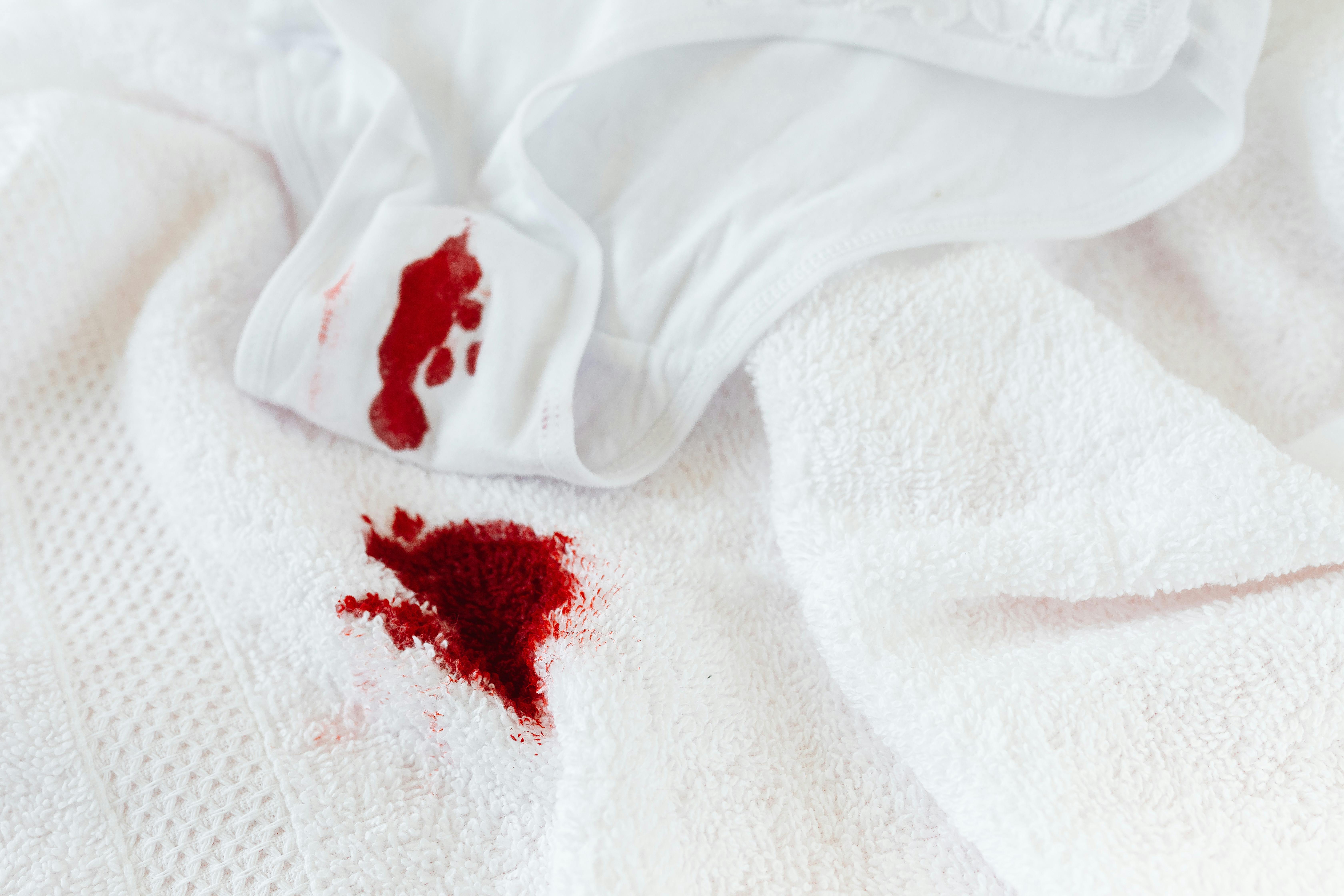 A Menstrual Stain on a Pad and Towel · Free Stock Photo