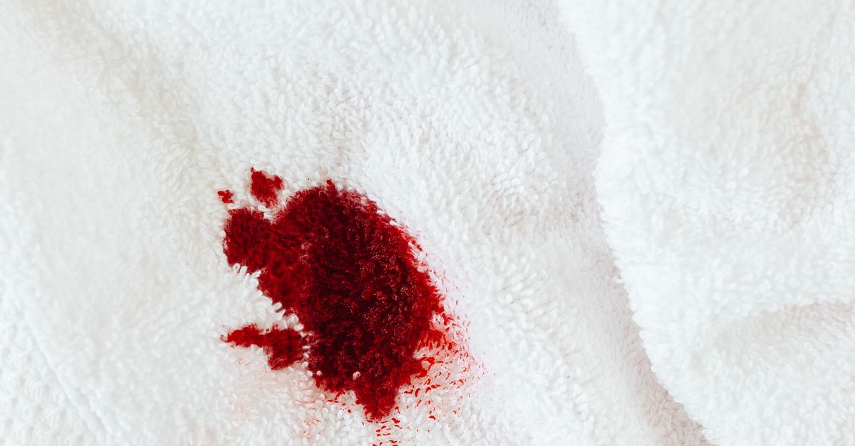 13 produtos eficazes para remover manchas das roupas