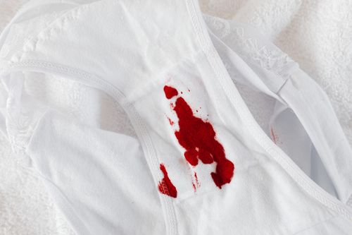 Free Close-up of white panties with red menstrual blood stain on white background. Stock Photo