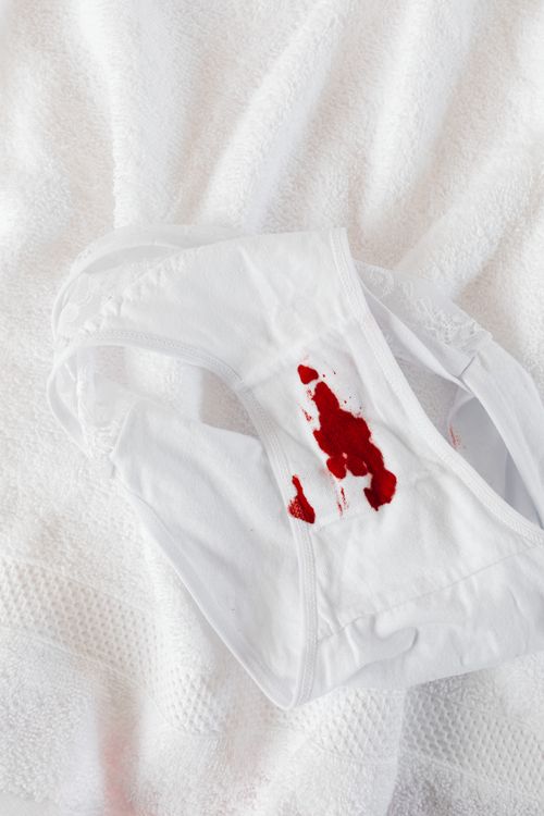 Free Image depicting menstrual blood on white underwear placed on a towel, highlighting women's health. Stock Photo