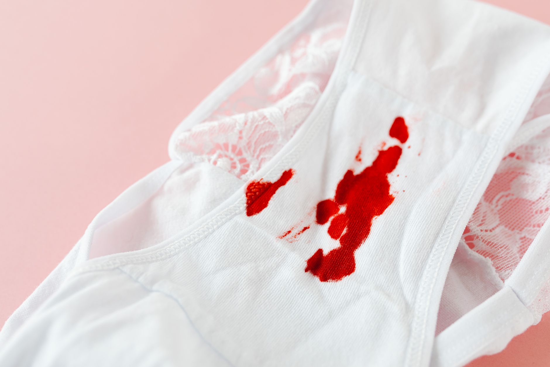 Detailed image of menstrual blood stains on white lace underwear against a pink background.