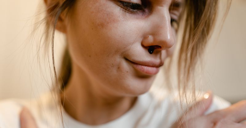 Enlever Points Noirs Nez : 10 Astuces Pro