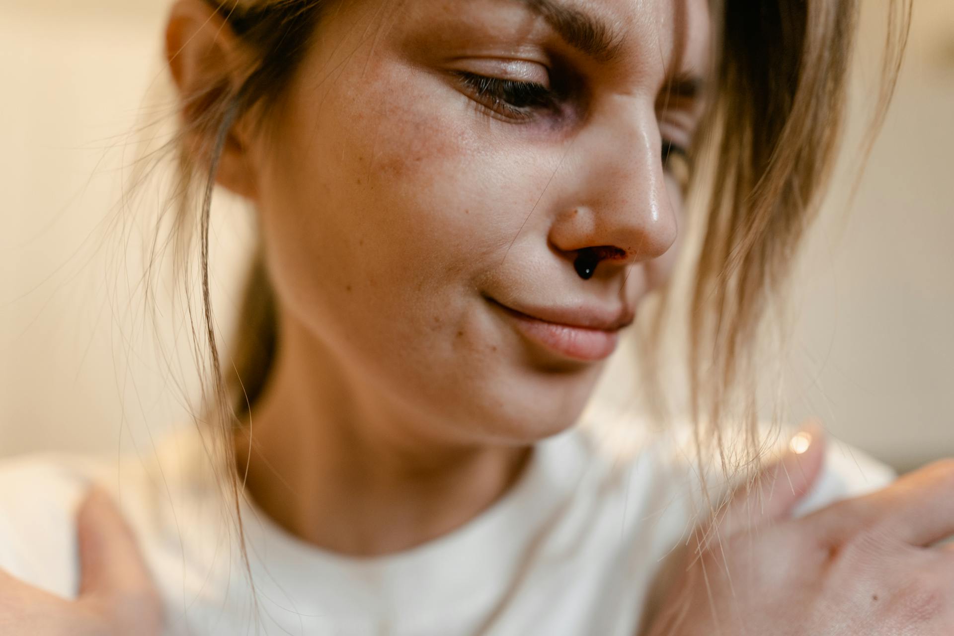 Blood Coming From the Woman's Nose