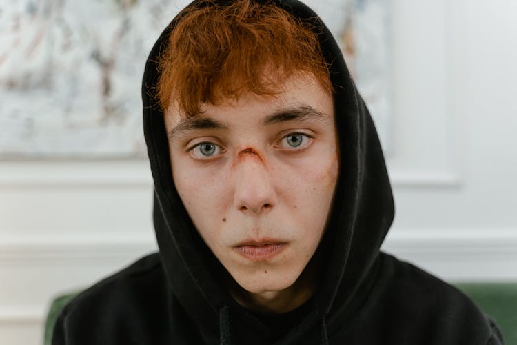 A Man In Black Hoodie  With Bruised  Nose