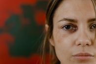 A Close-up Shot of a Woman with Black Eye