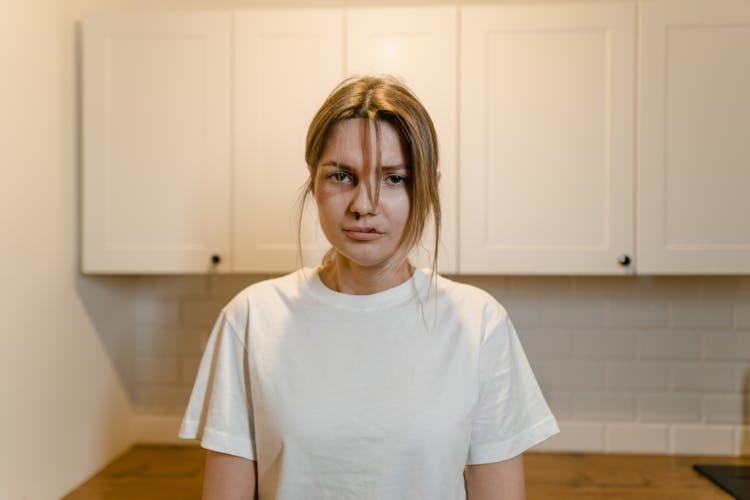 Woman In White Shirt With Bruises On Face