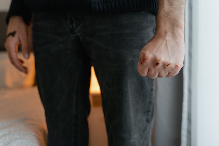 Wounds On The Persons Knuckles