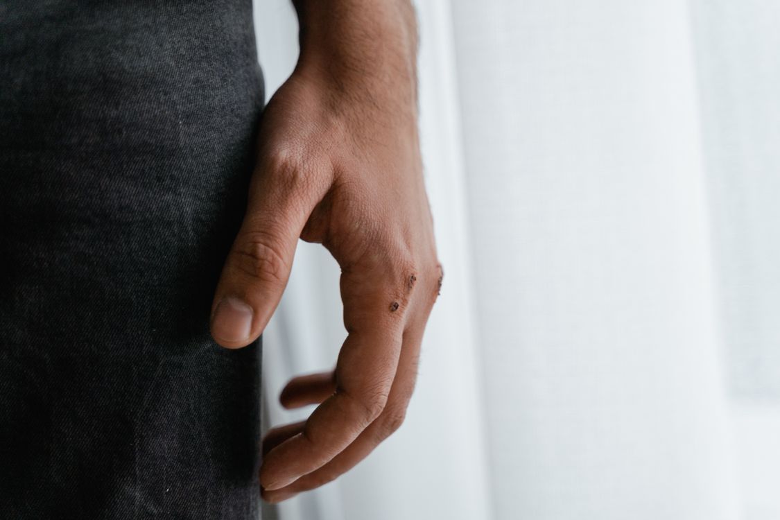 Close-Up Shot of Wound on a Person's Hand · Free Stock Photo