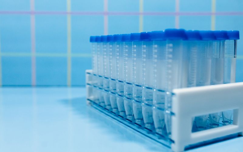 Laboratory test tubes in a plastic rack on a reflective blue surface.
