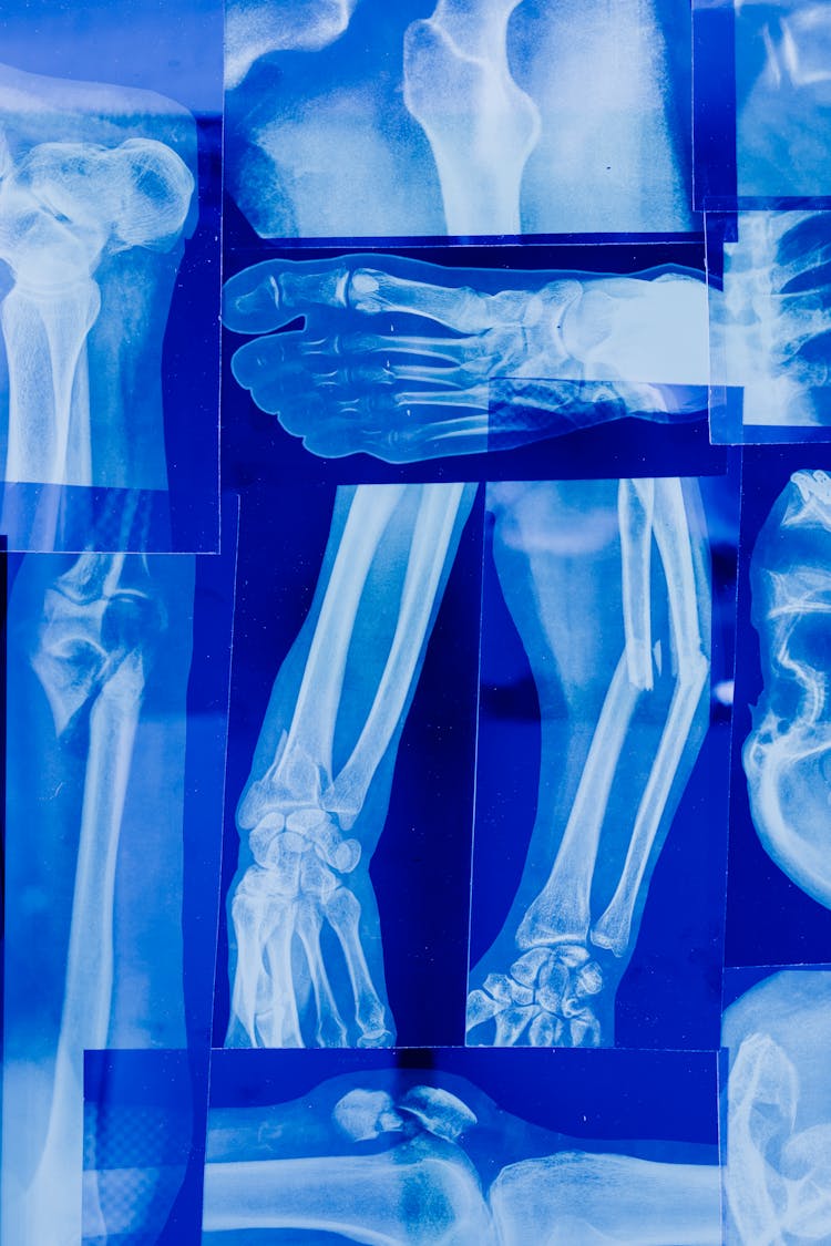 A Various X-ray Imaging Of A Person's Bones