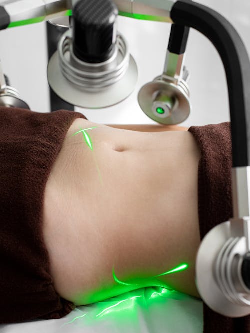 Free Unrecognizable woman with lasers on belly during fat loss treatment Stock Photo