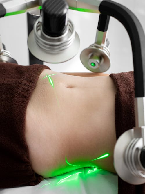 Unrecognizable woman with lasers on belly during fat loss treatment