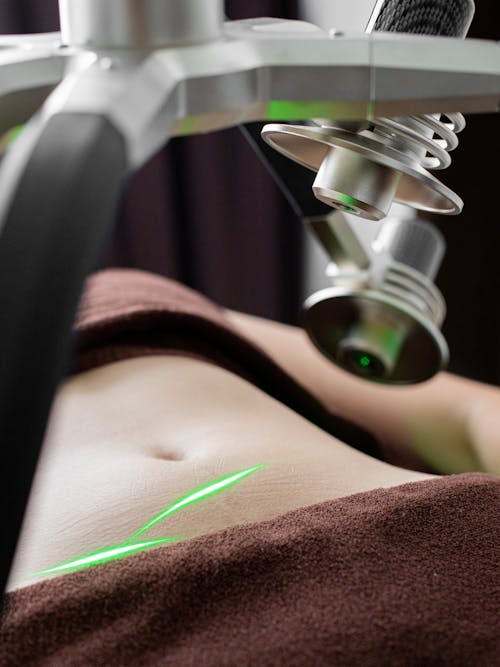 Anonymous woman with lasers on belly