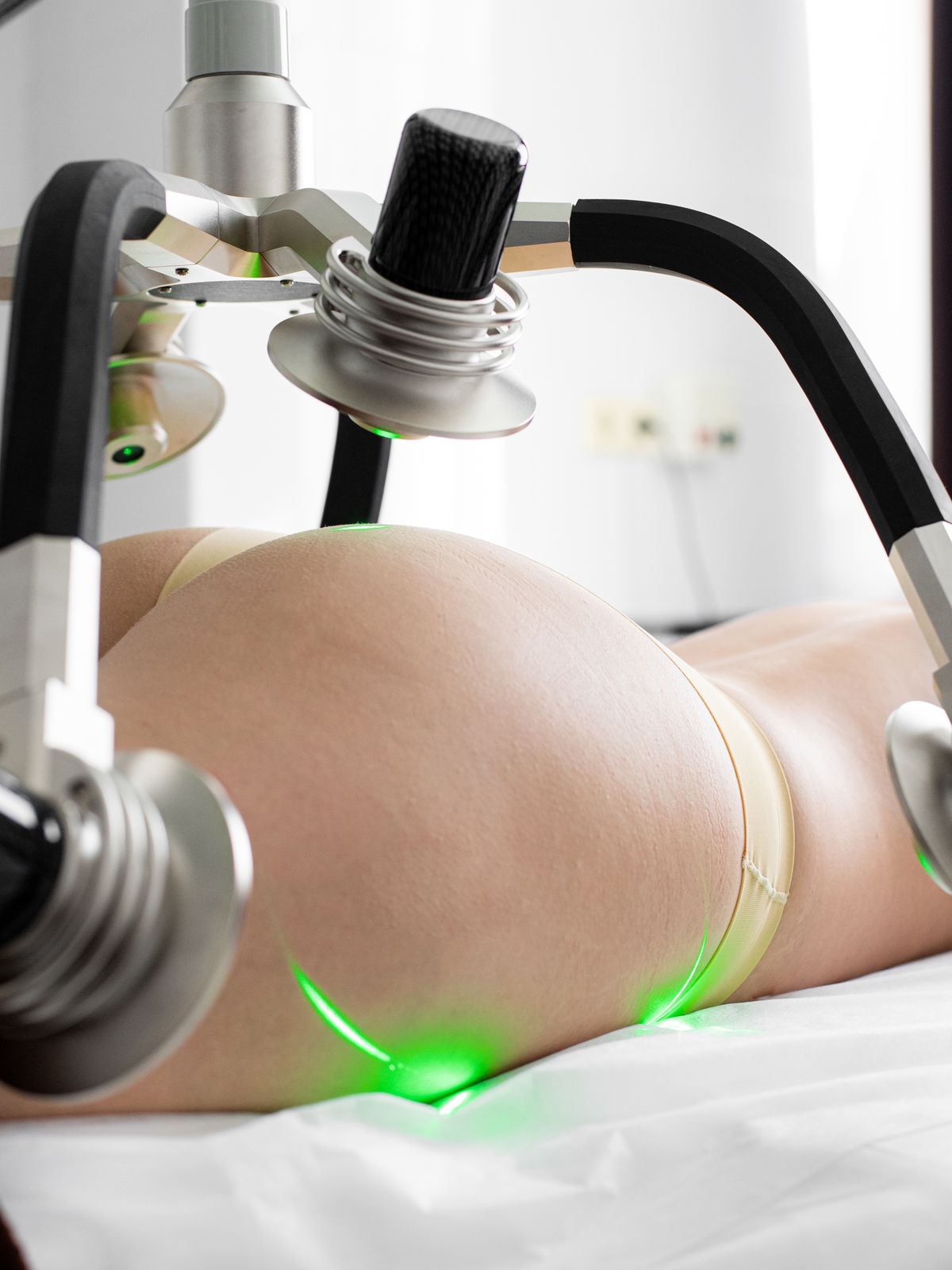 Client receiving a non-invasive laser body sculpting treatment on a clinic couch