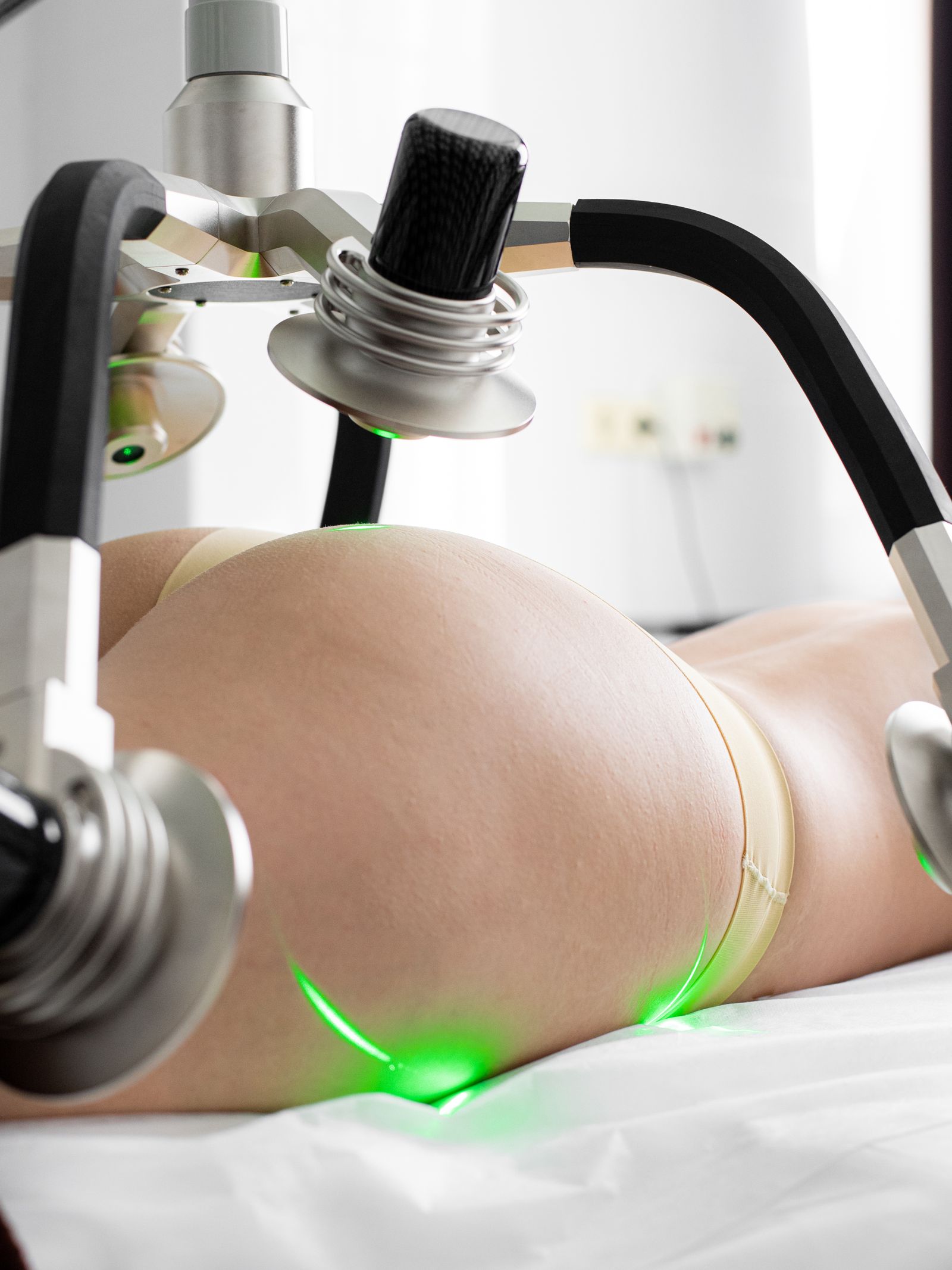 Non-invasive laser body contouring treatment