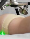 Woman doing procedure with laser