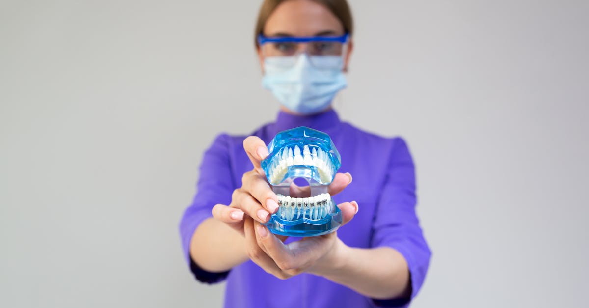 How to clean mouth guard against dentist