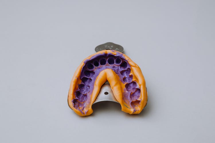 Alginate Impression Of Teeth On Impression Tray