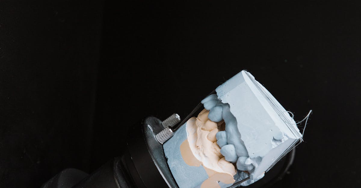How long pain after tooth extraction and implant