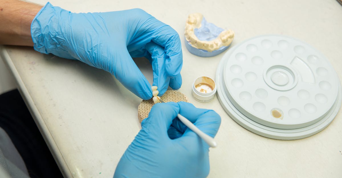 Do delta dental cover implants