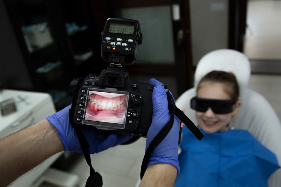 Smile Makeover before — demo photography