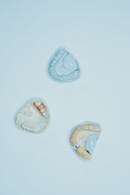 Three dental molds displayed on a blue background in a top-view vertical shot.