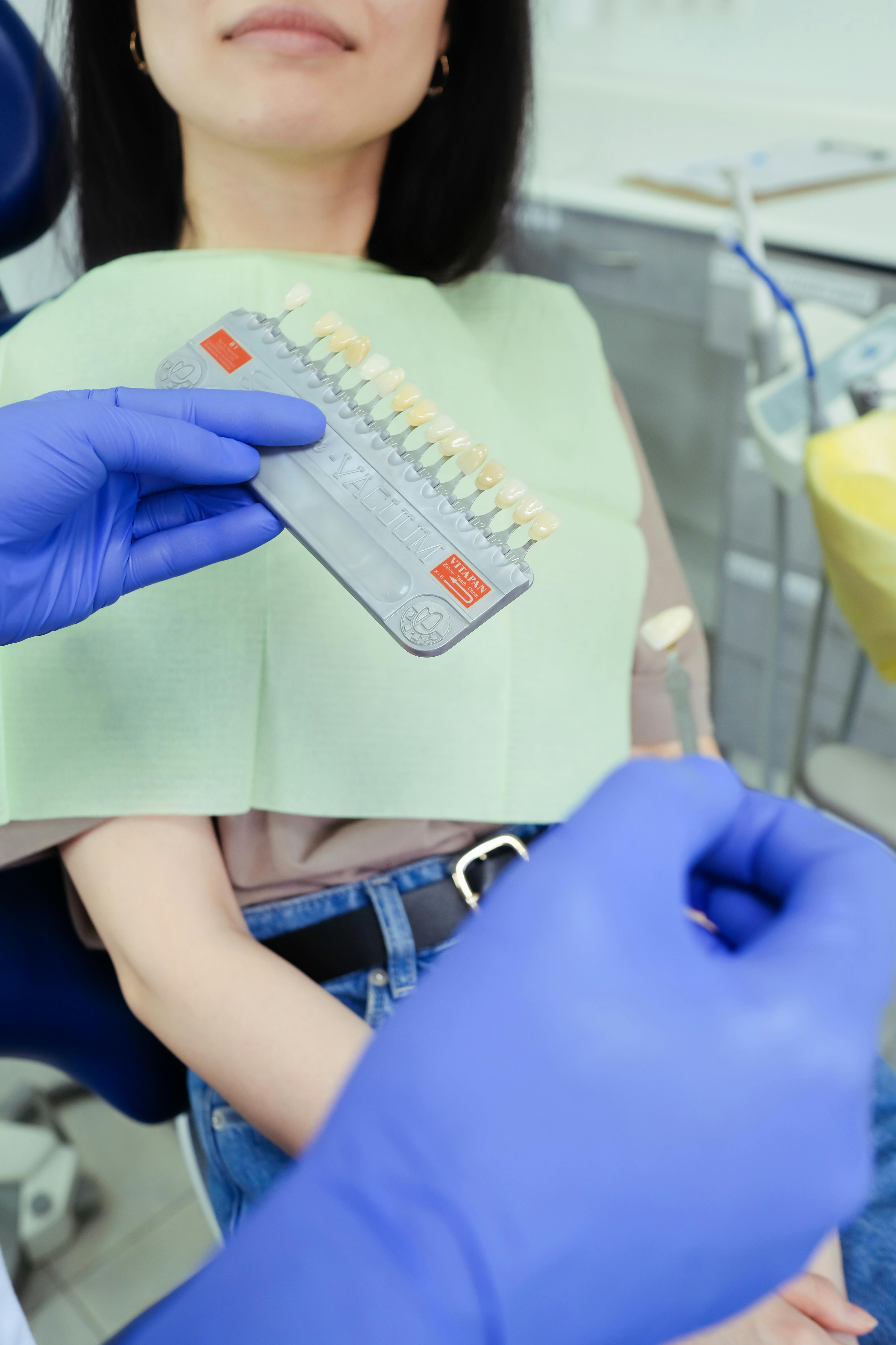 When Teeth Whitening Does Not Work