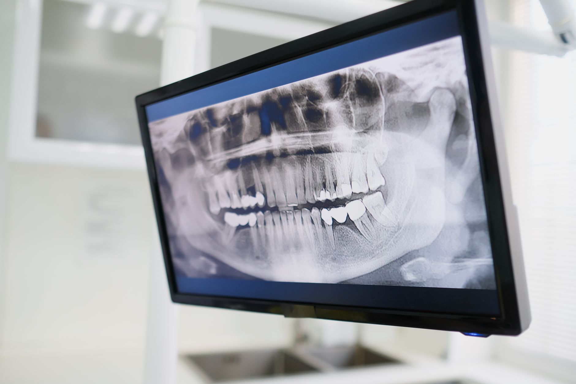 Digital Radiography in a Dentistry setting — illustrative photo for Kleinburg, ON guide. Digital Radiography in a Dentistry setting — illustrative photo for Kleinburg, ON guide.