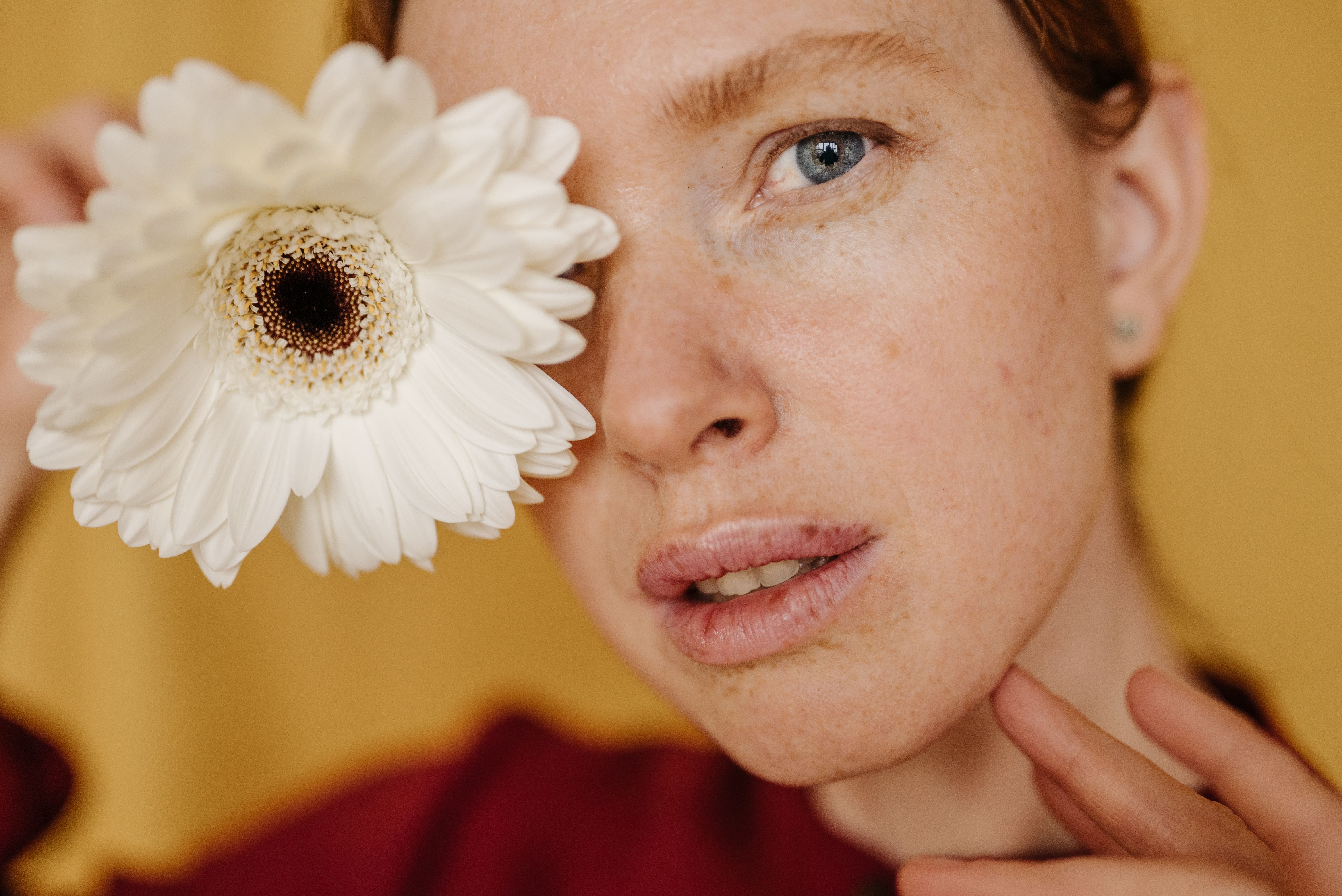 Melasma treatment before after — Dicas de Beleza