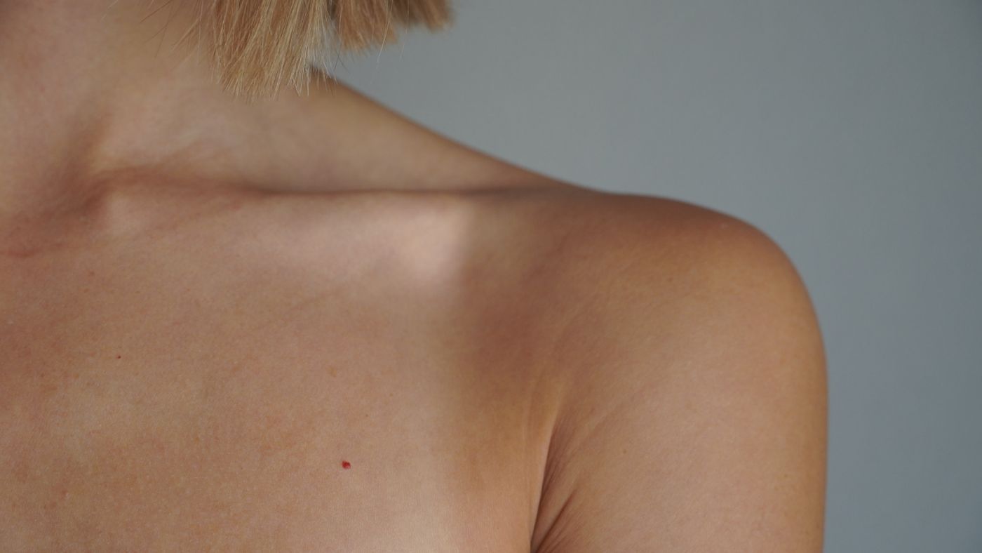 Treating Common Skin Problems Without Overreacting