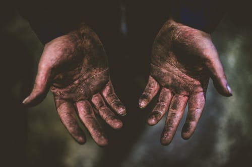  Person with Dirty Hands