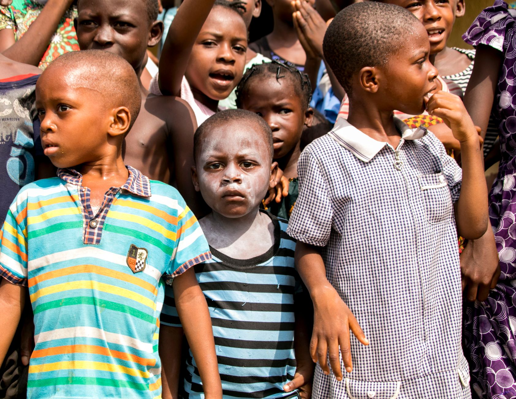 Vibrant group of African children expressing various emotions in an outdoor setting.