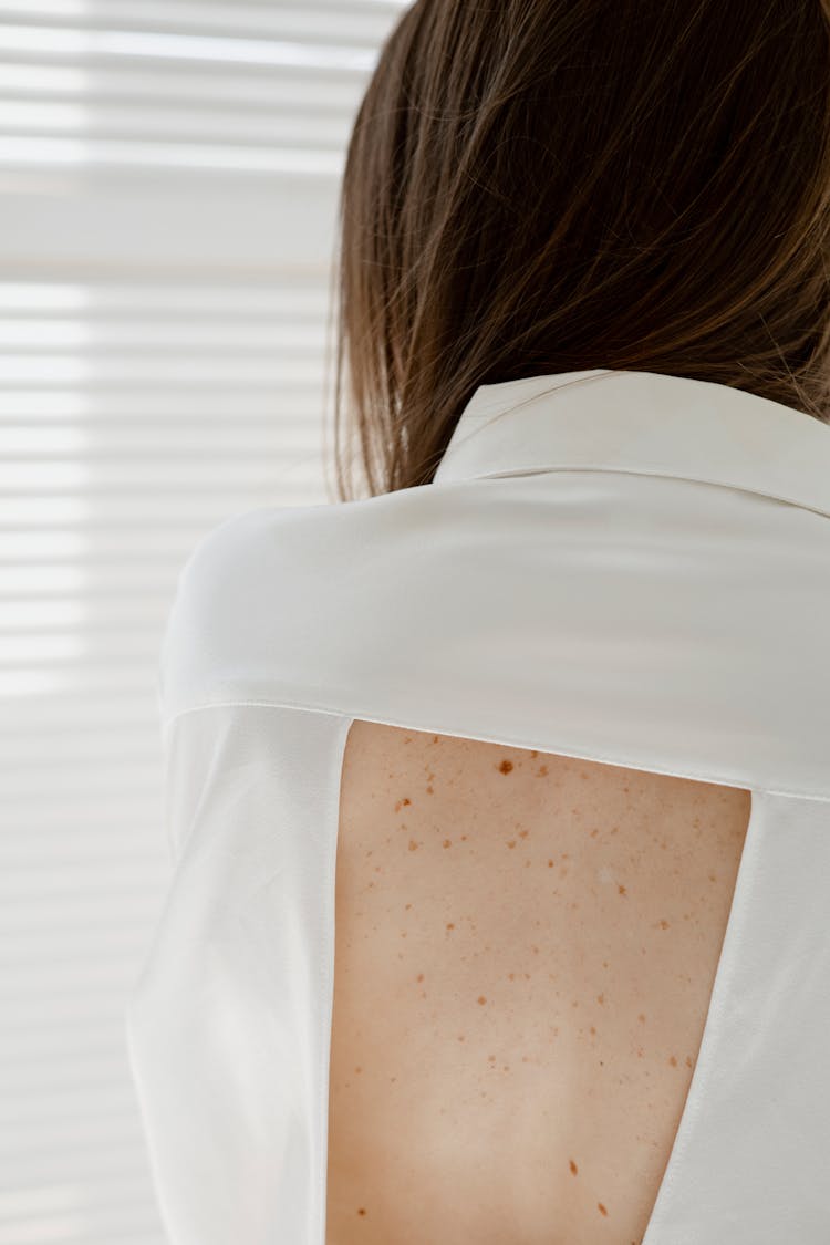 A Woman With Freckles On Her Back