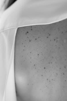 Artistic black and white close-up of freckled skin showcasing texture and detail.