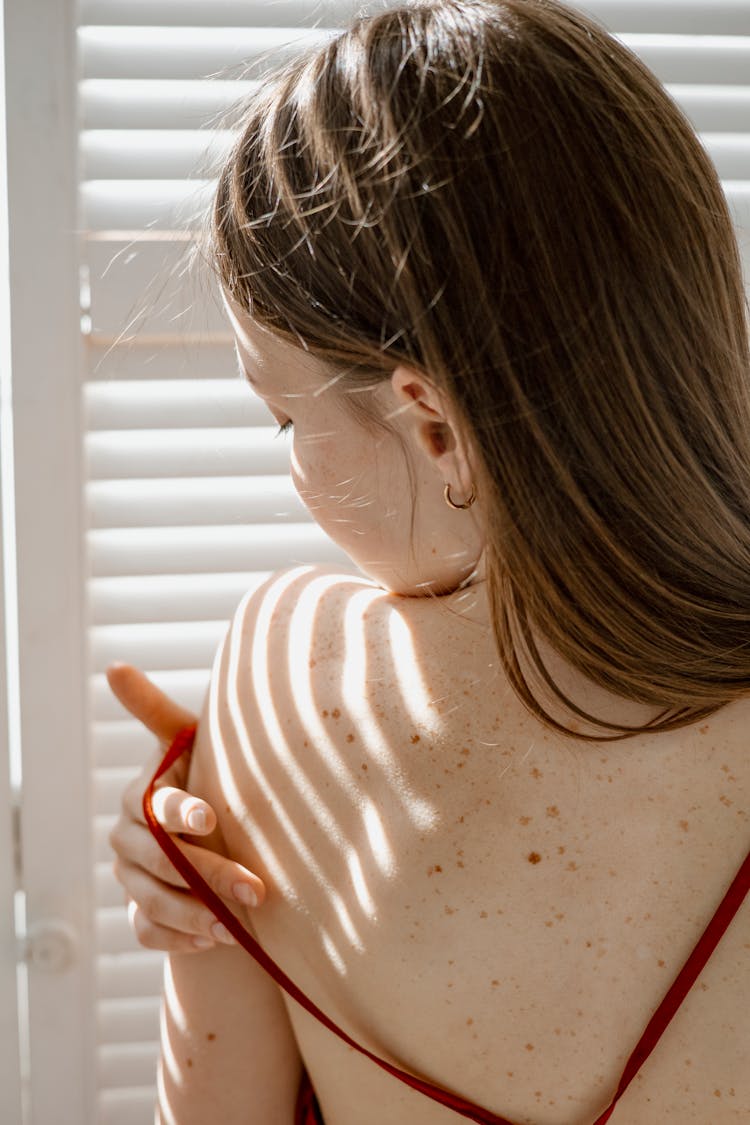 A Woman With Freckles On Her Back