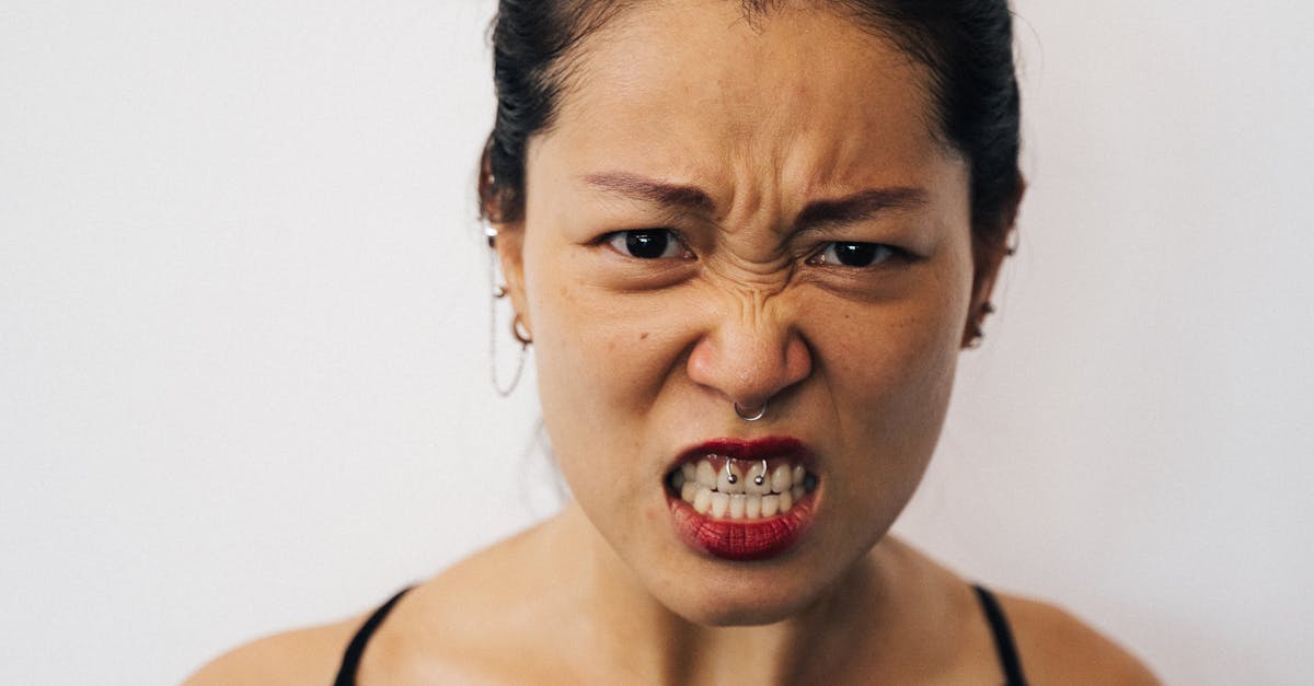 Does medicaid cover braces in Texas 2020