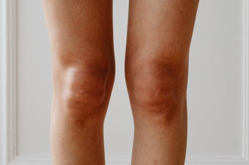 Close up of Female Legs and Knees