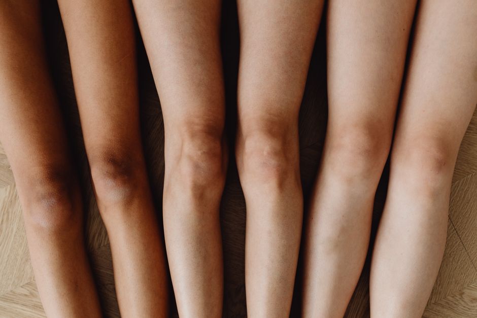 How to Get Rid of Dark Elbows & Knees: 6 Clinically-Proven Methods