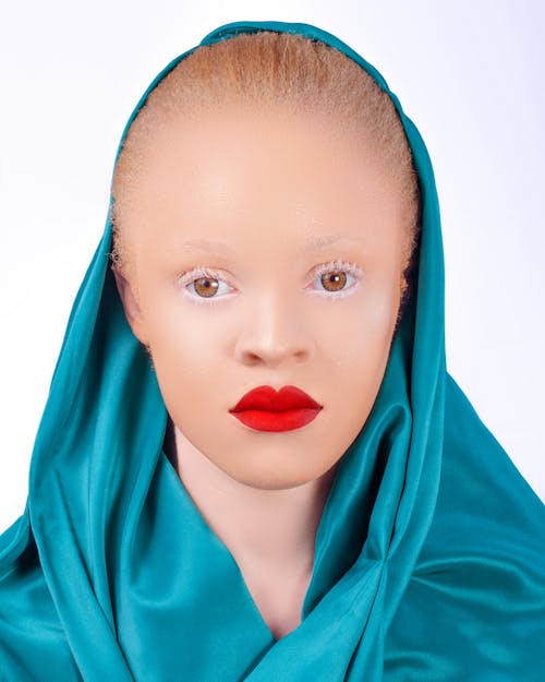 Gratis lagerfoto af afrikansk kvinde, albinisme, kvinde
