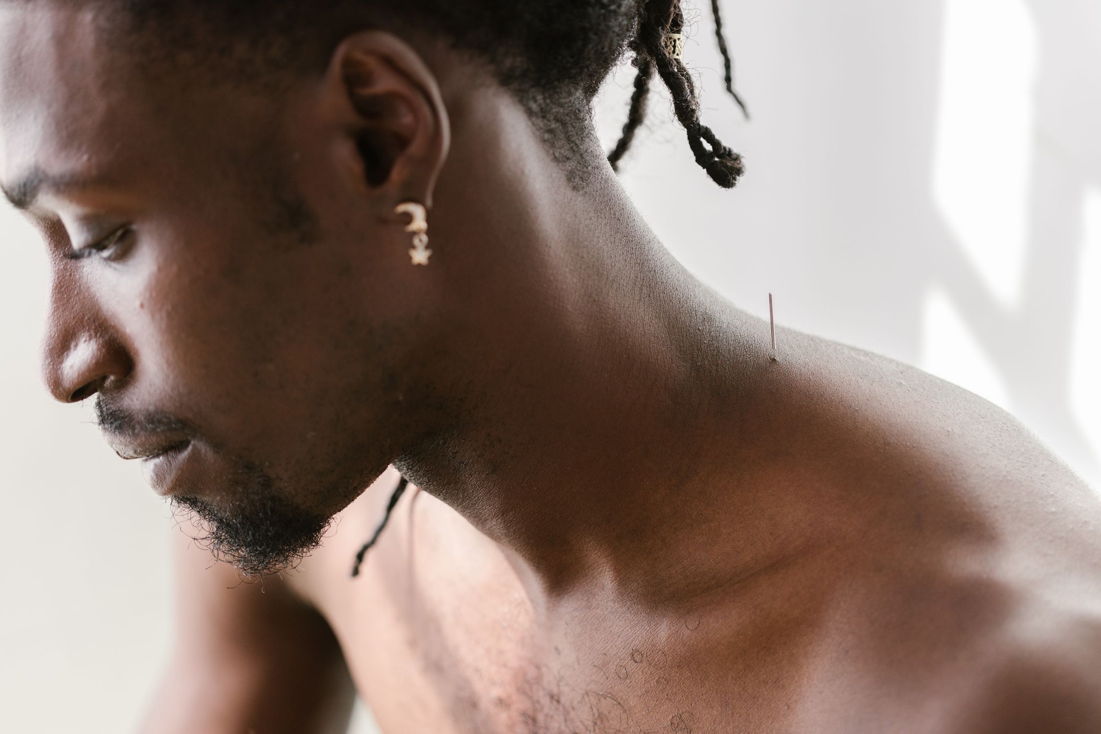 Acupuncture Treatment and Its Benefits Acupuncture Treatment and Its Benefits