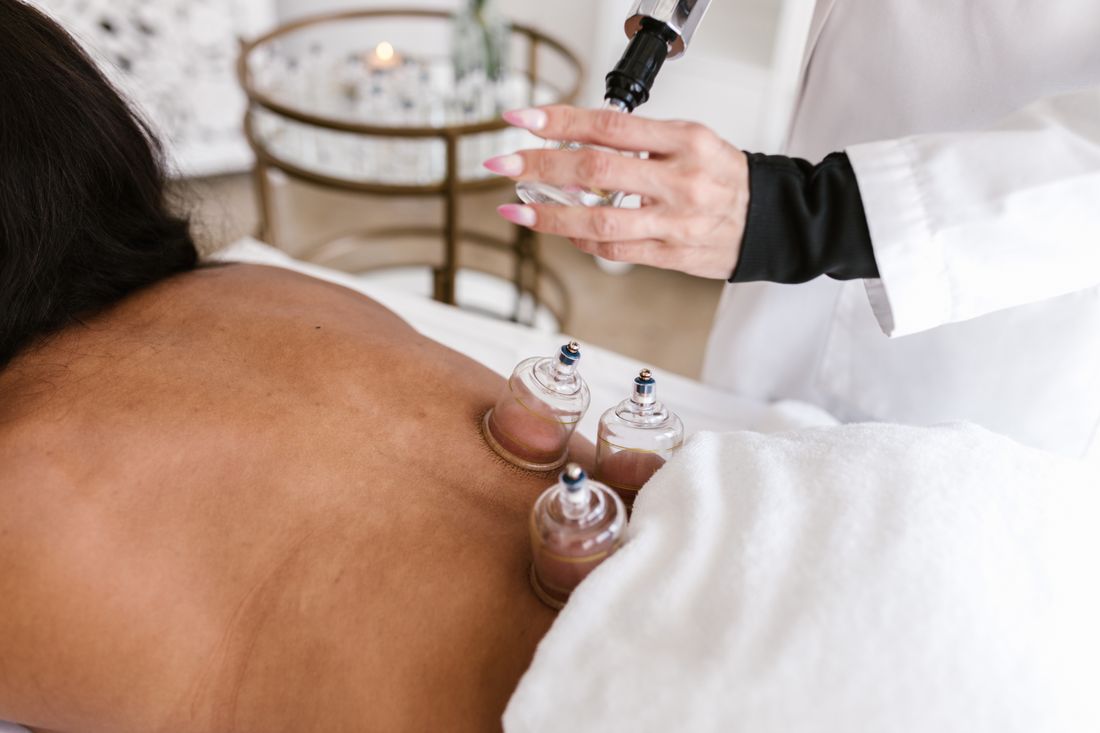 Cupping Therapy session at Wellness by Marusa