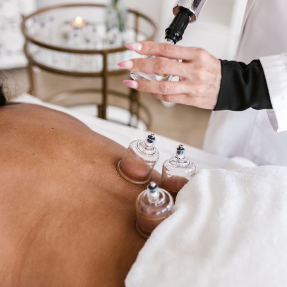 Cupping therapy on the back