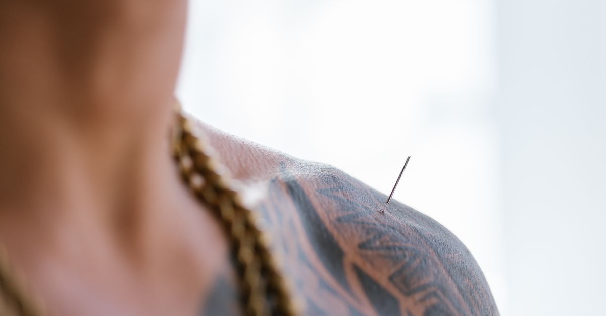 National Standards for Acupuncture to Be Implemented