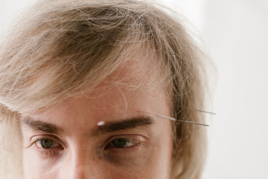 A detailed close-up of acupuncture needles inserted in a man's forehead for holistic treatment.