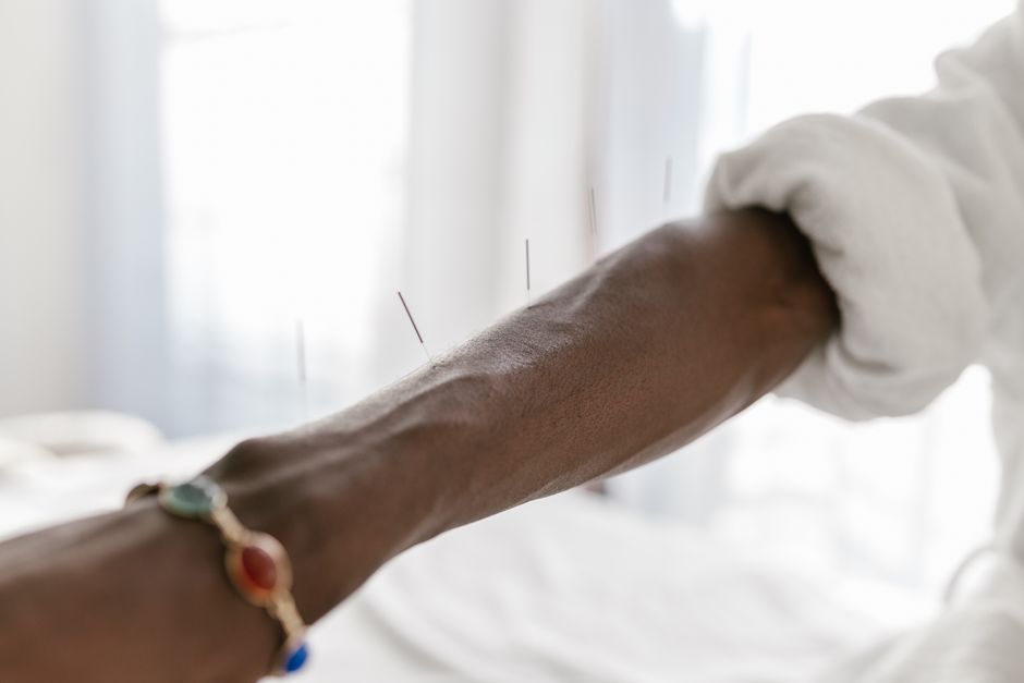 Votre Entreprise, Acupuncteur à Florac Trois Rivières
