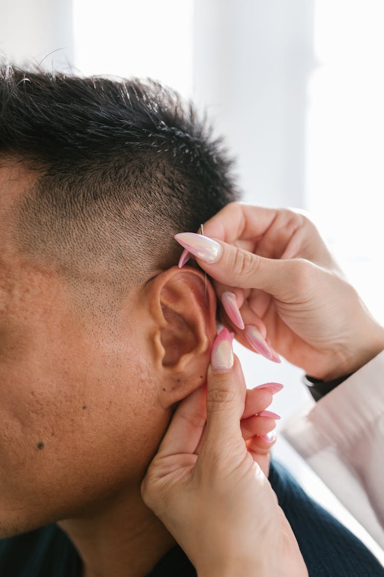 A Therapist Putting A Needle At A Man's Ear Acupuncture Point