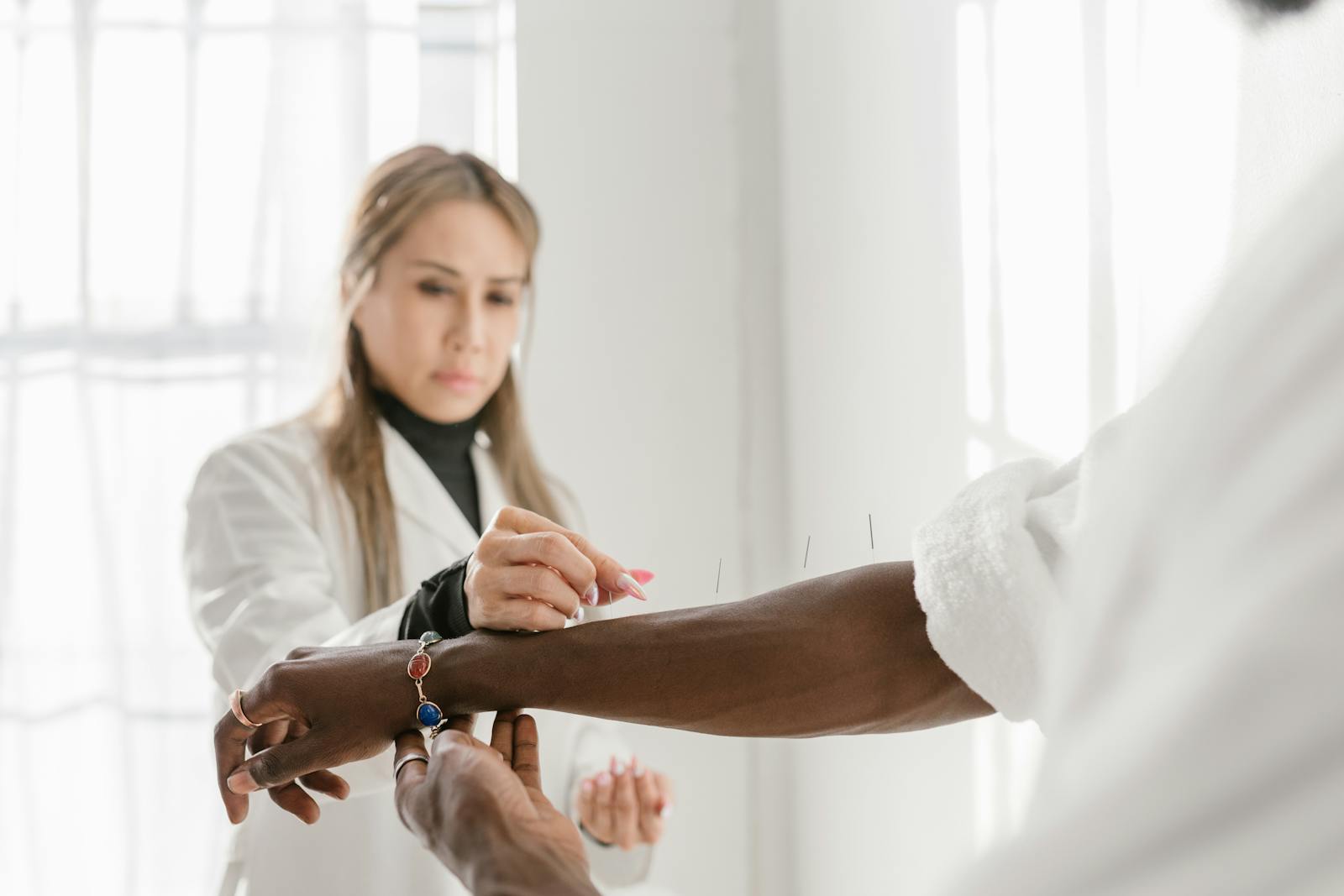 Acupuncture therapy session