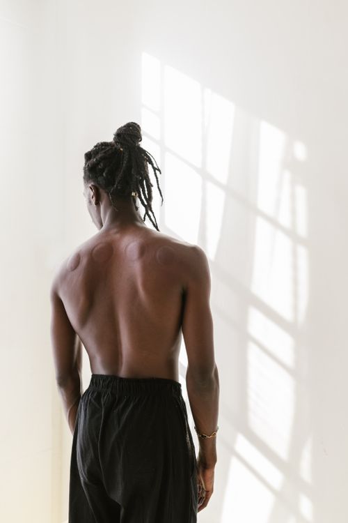 Free Shirtless man standing with visible cupping marks on his back, indoors lighting. Stock Photo