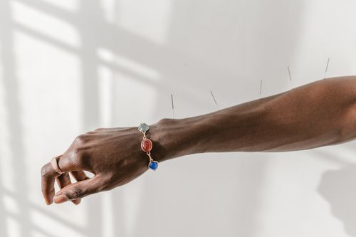 Free A close-up shot of a hand wearing a gemstone bracelet with acupuncture needles on the arm. Stock Photo
