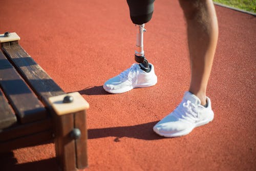 Free A Person with Prosthetic Leg Standing Stock Photo